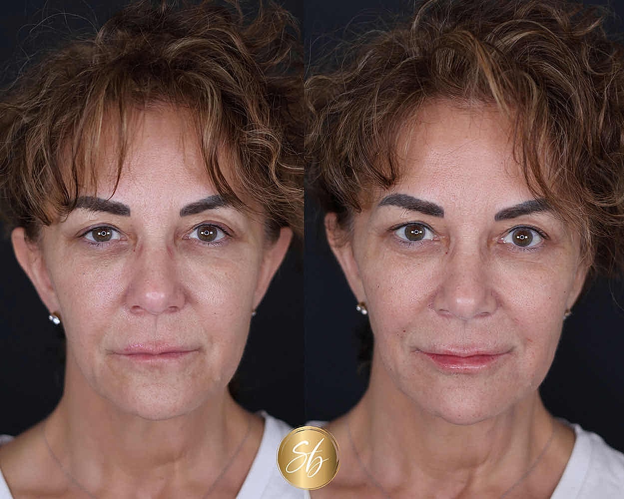 Before and after beauty transformation comparison.