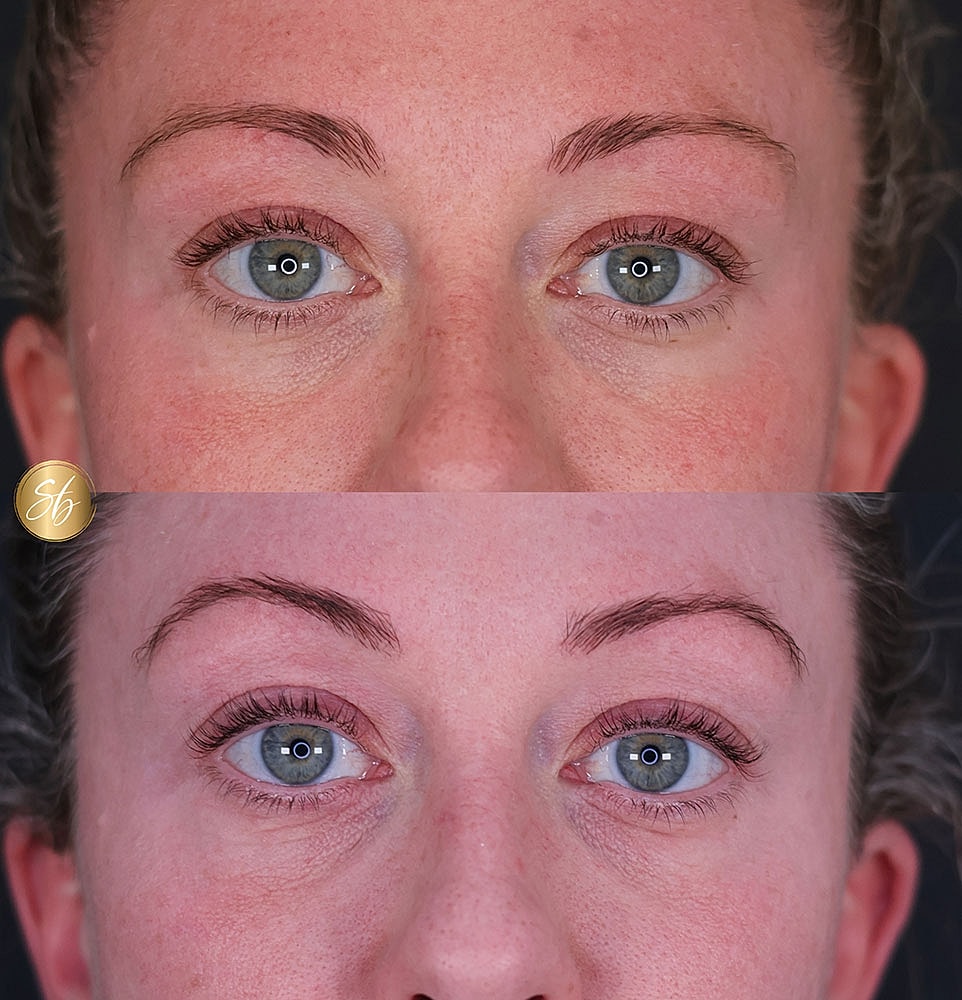Before and after eyelash enhancement comparison.